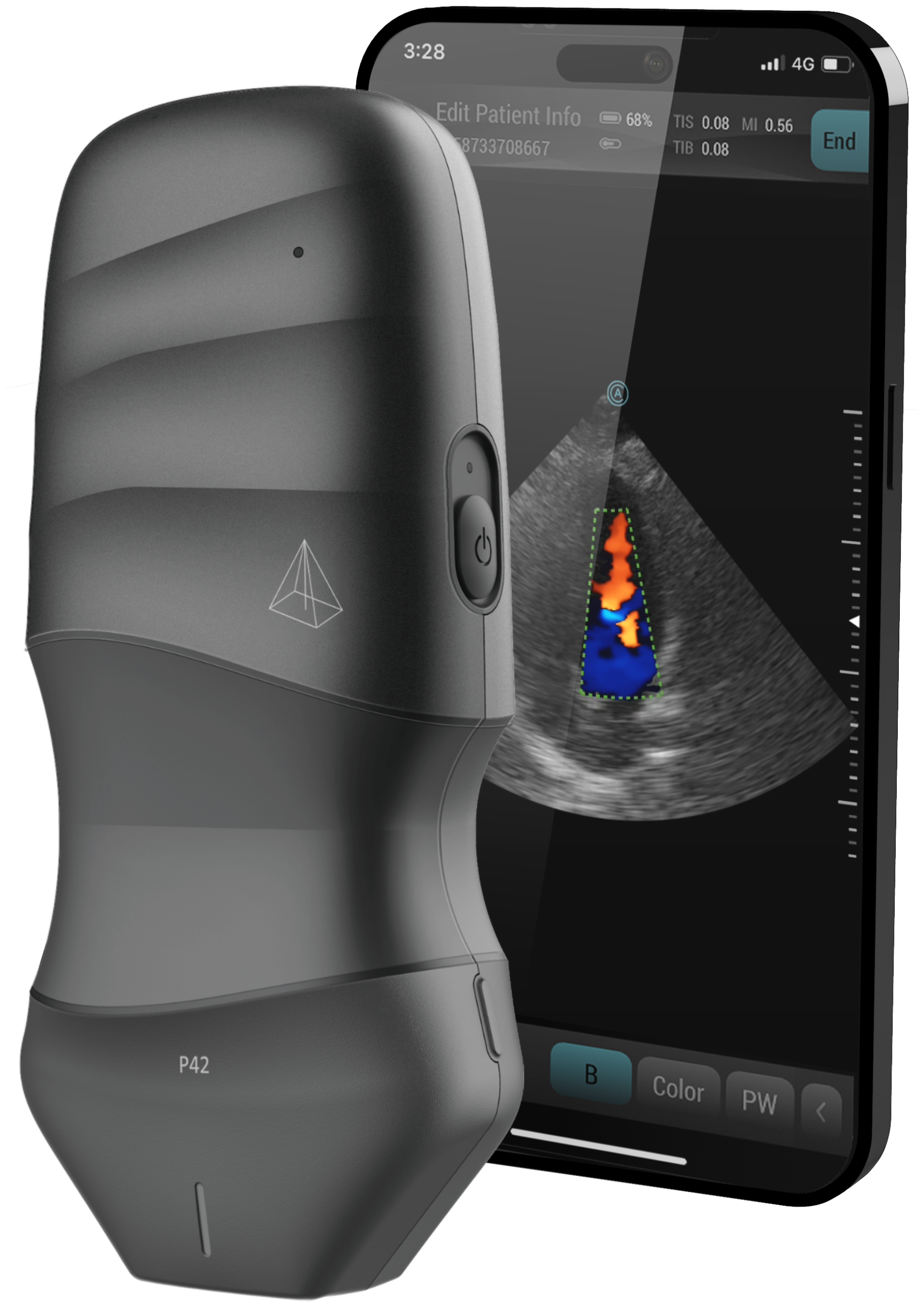 view of the P42 wireless handheld ultrasound for abdomen bladder cardiac fast ob/gyn transcranial and lung displying color mode on a cell phone.