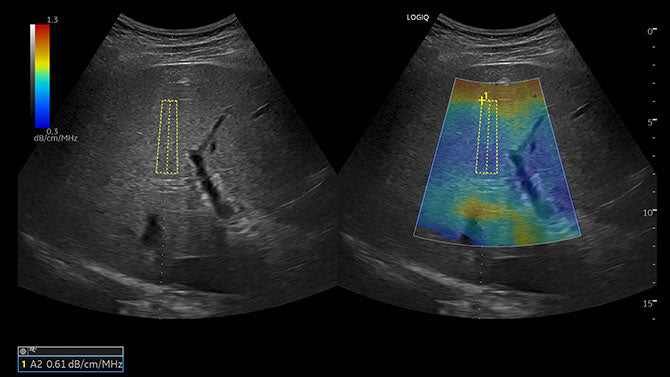 GE Logiq P6 Ultrasound