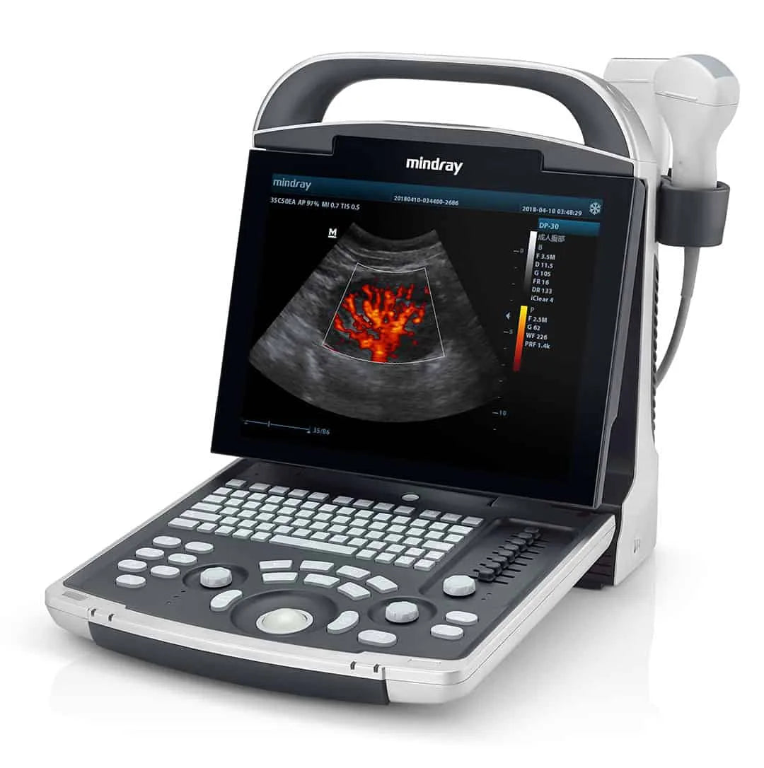 Mindray DP-30 Ultrasound System