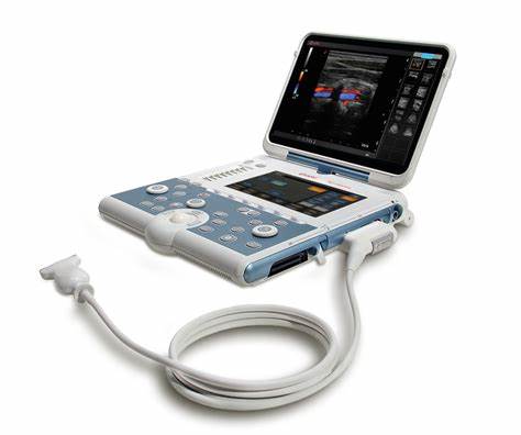 Esaote MyLab Gamma Ultrasound