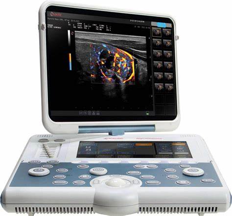 Esaote MyLab Gamma Ultrasound