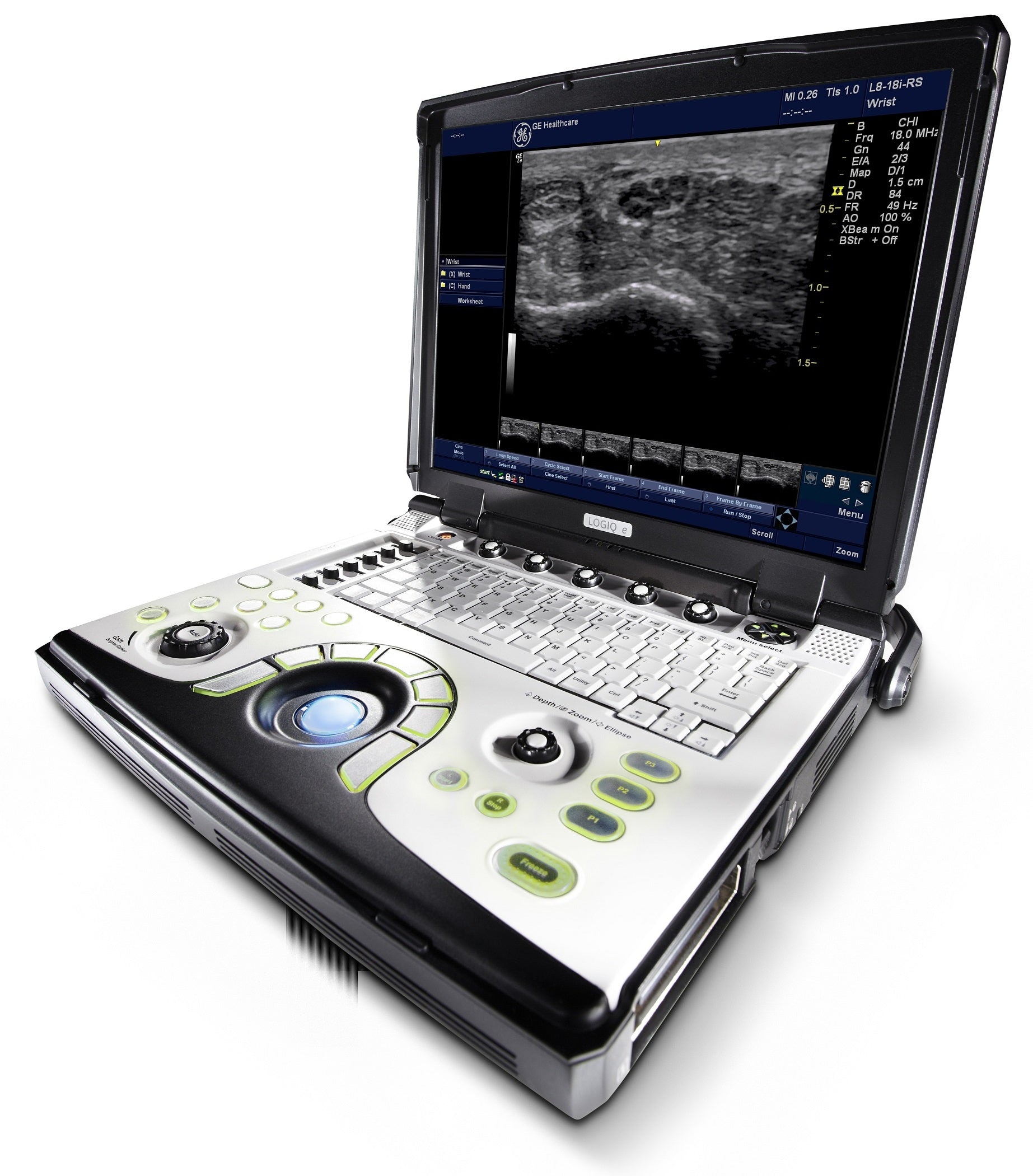 GE Logiq E Ultrasound