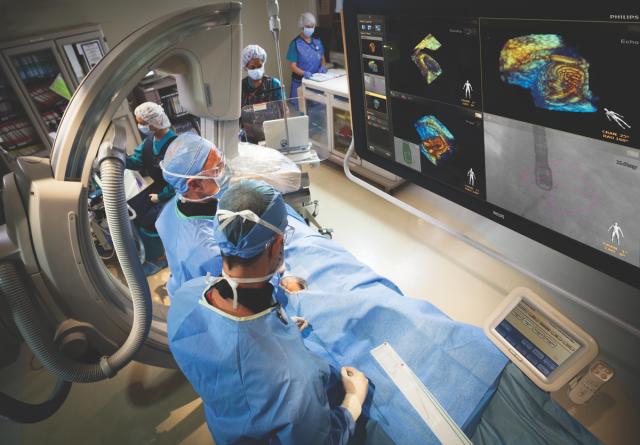 Philips CX50 Ultrasound