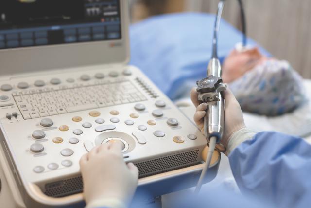 Philips CX50 Ultrasound