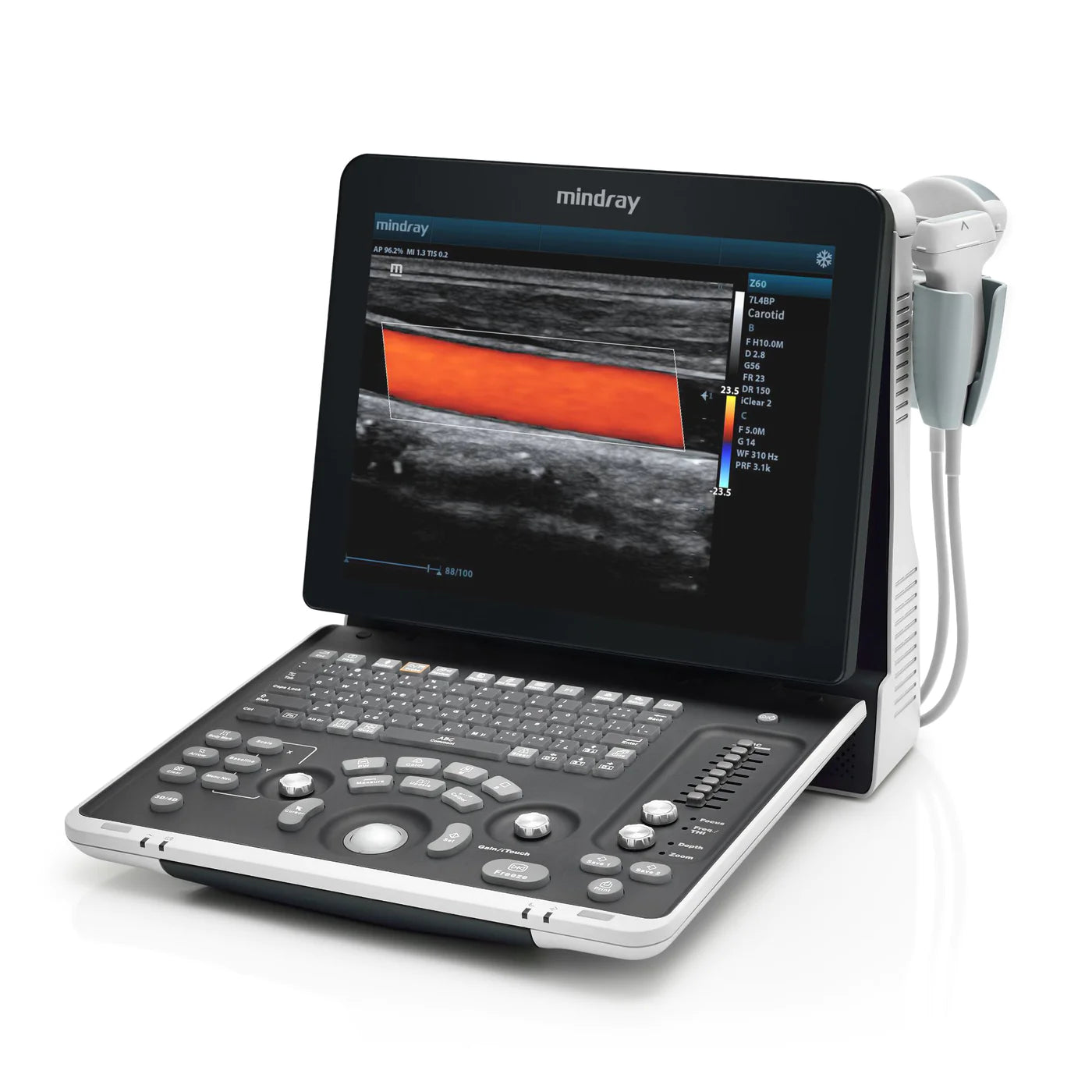Mindray Z60 Ultrasound System