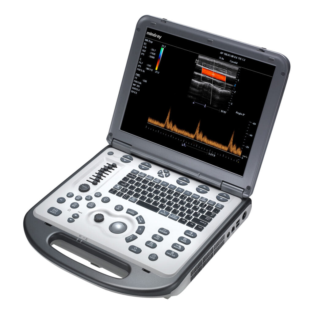 Mindray M6 Ultrasound System