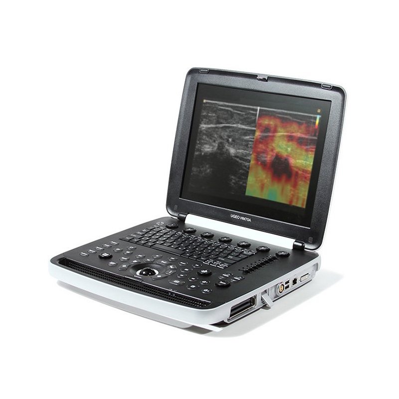 Samsung Medison UGEO HM70A Ultrasound