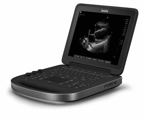SonoSite Edge ll Ultrasound