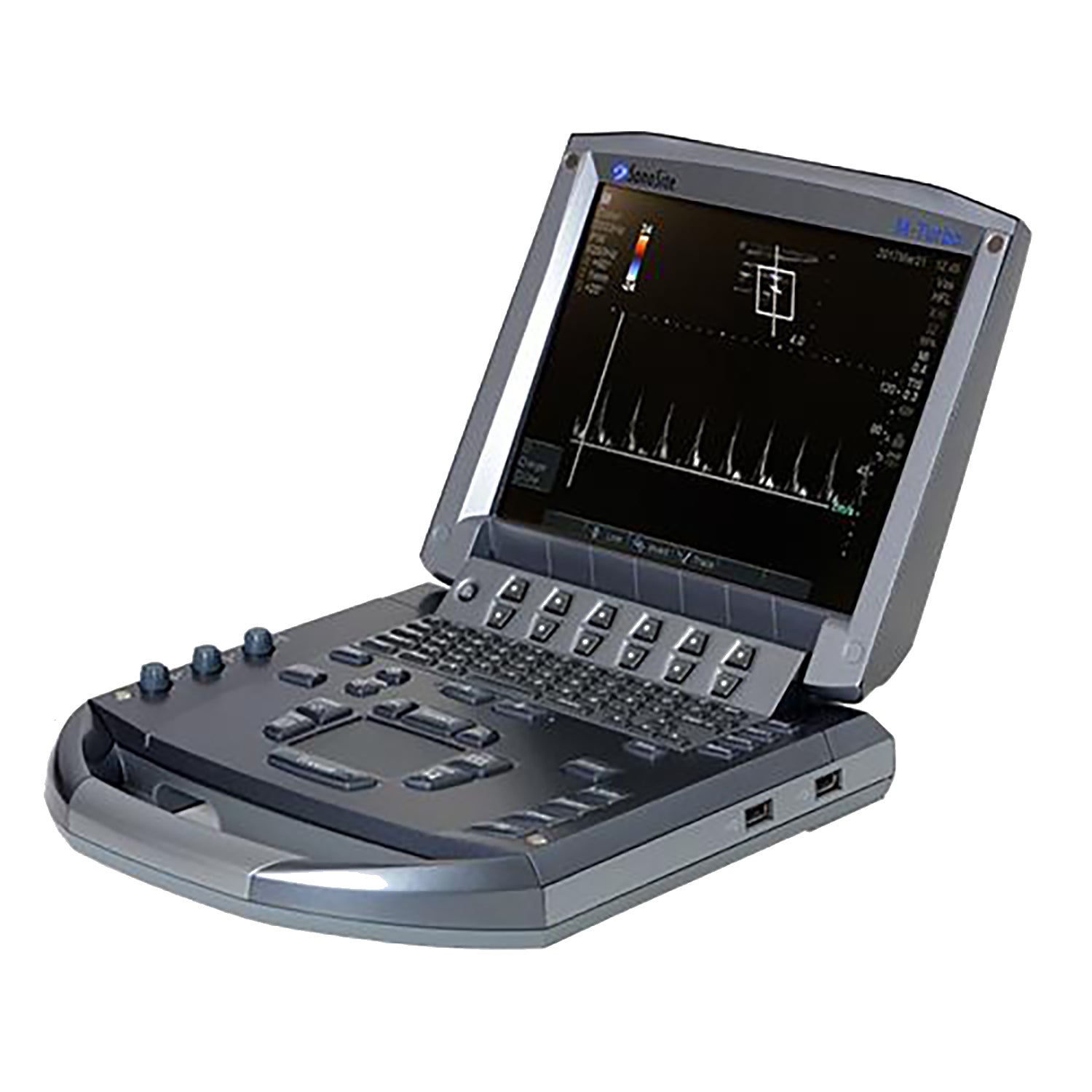 SonoSite M-Turbo Ultrasound
