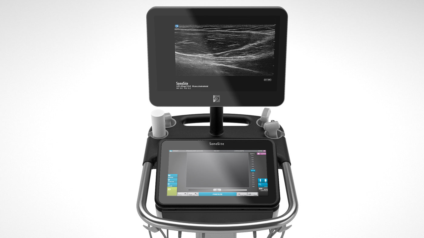 SonoSite X-Porte Ultrasound