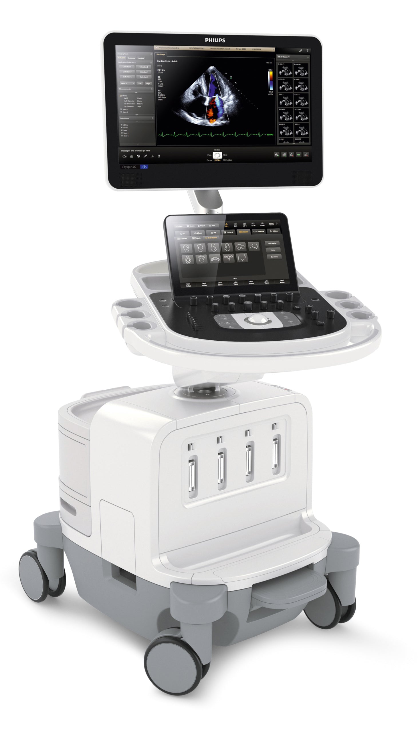 Philips EPIQ 5 Ultrasound