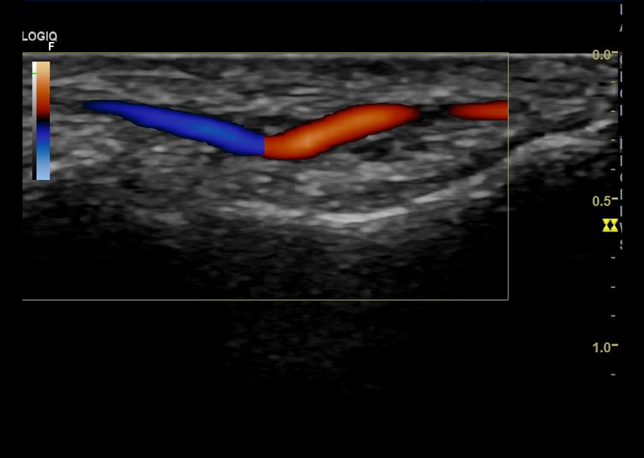 GE Logiq F6 Ultrasound