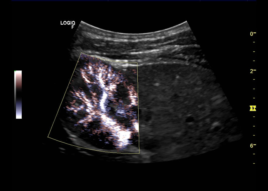 GE Logiq F8 Ultrasound