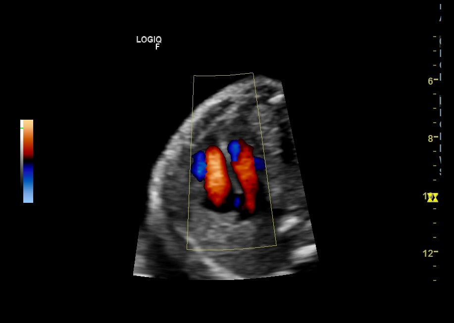 GE Logiq F8 Ultrasound