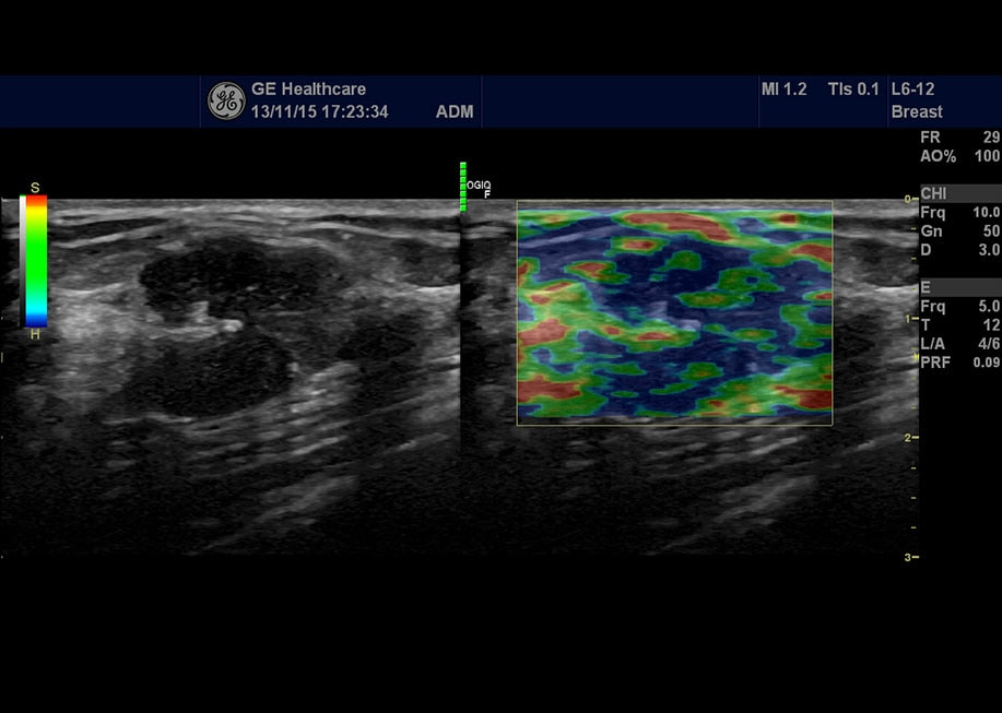 GE Logiq F8 Ultrasound