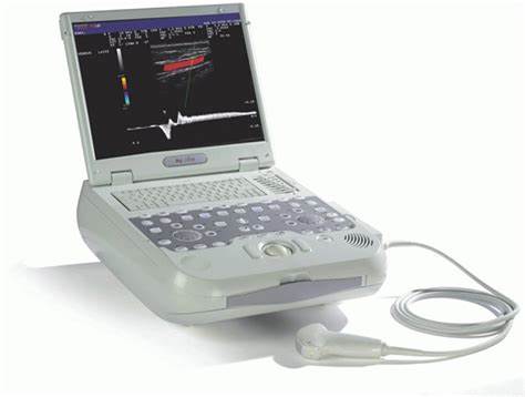 Esaote MyLab Five Ultrasound
