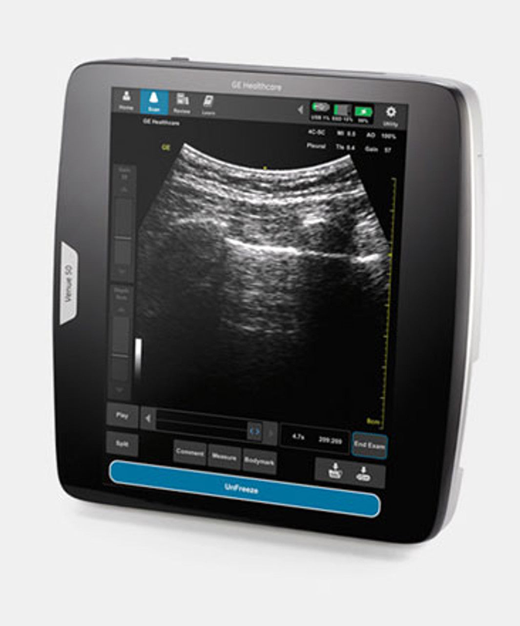 GE Venue 50 Ultrasound