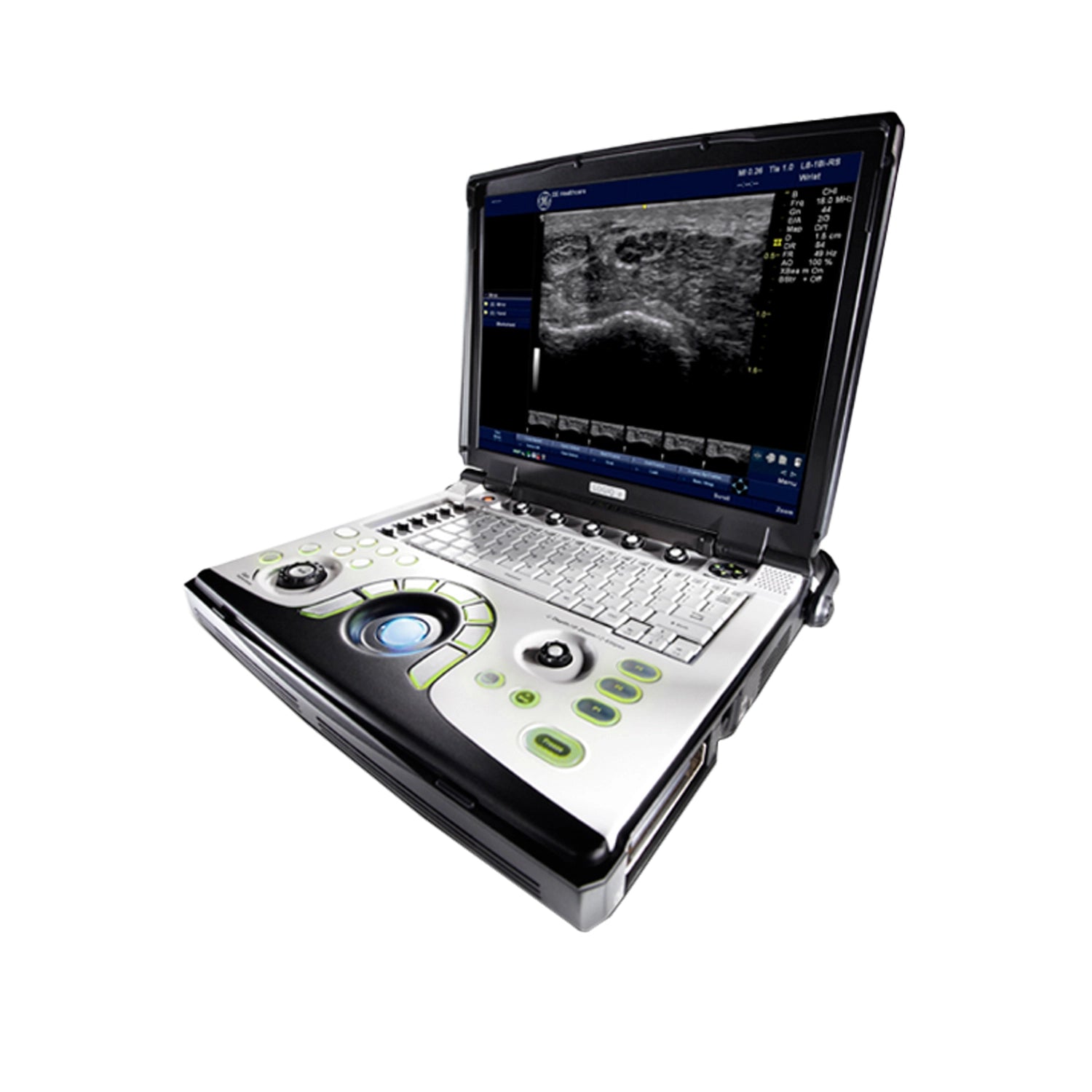 GE NextGen Logiq e Ultrasound