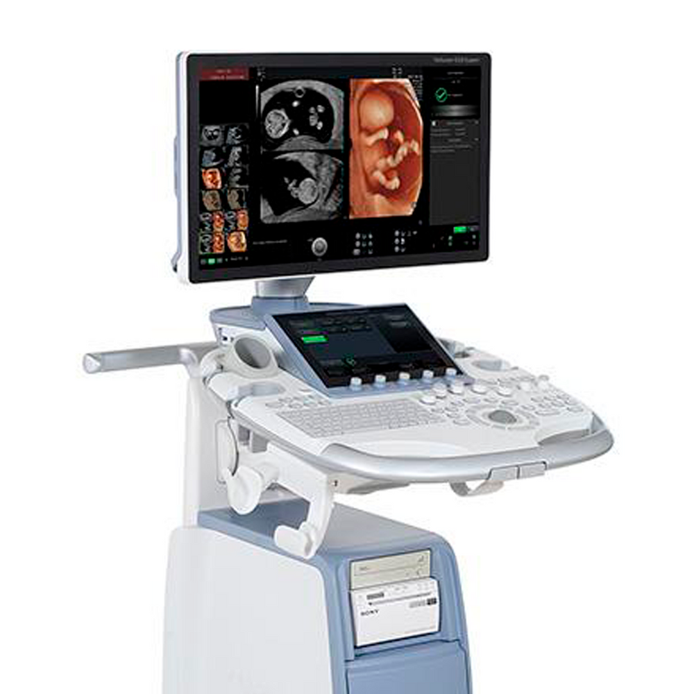 Ge Voluson GE Voluson S10 Ultrasound