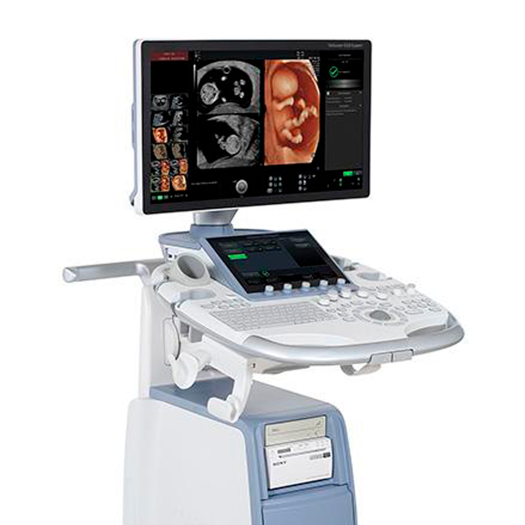 GE Voluson S10 Ultrasound
