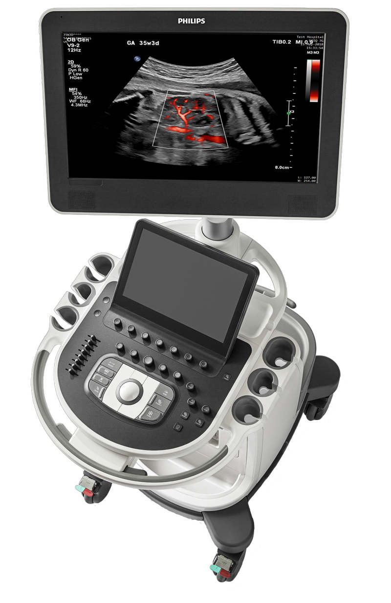 Philips Affiniti 50 Ultrasound