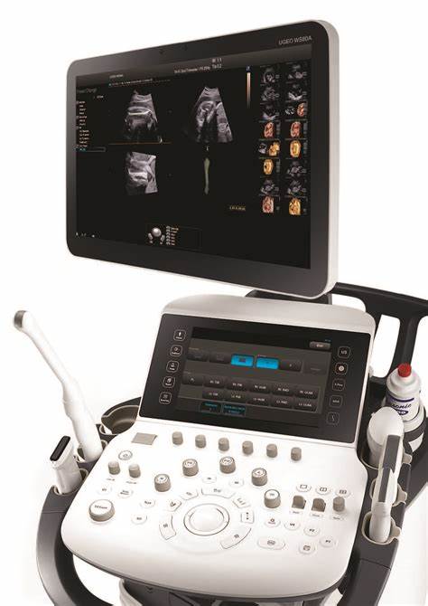 Samsung Medison WS80A Ultrasound