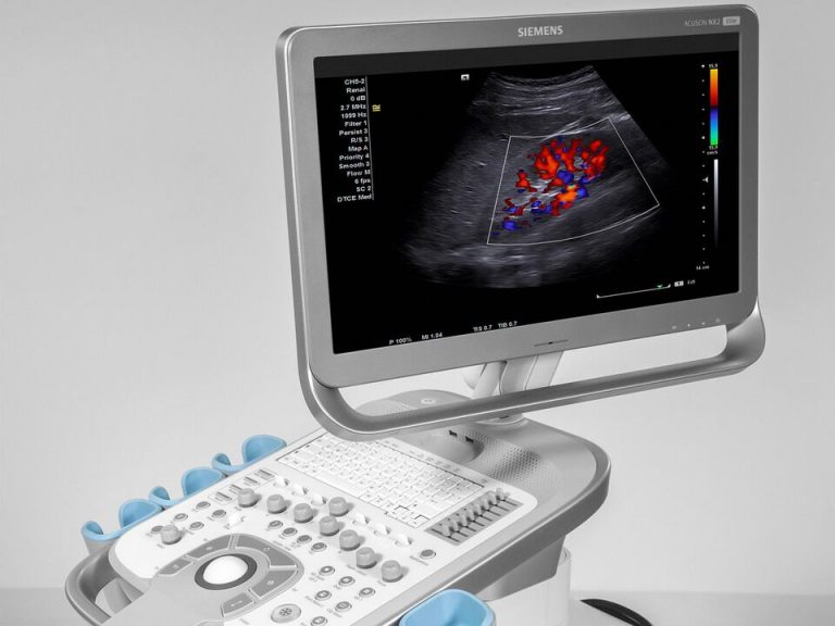 Siemens Acuson NX2 Ultrasound