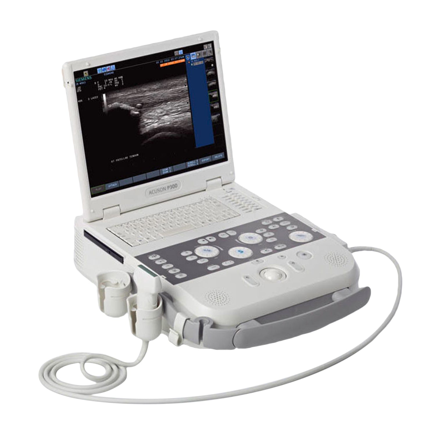 Siemens Acuson P300 Ultrasound