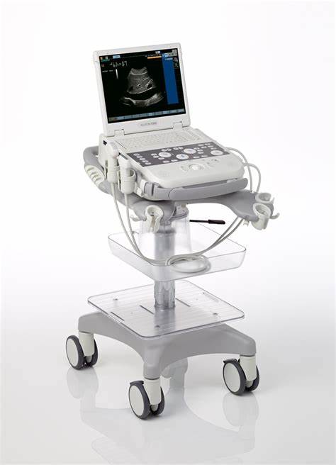 Siemens Acuson P300 Ultrasound