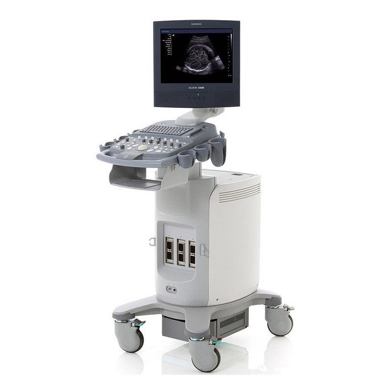 Siemens Acuson X150 Ultrasound