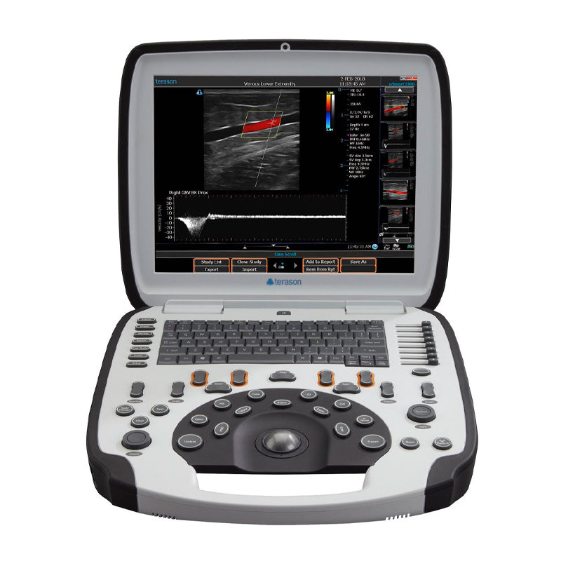 Terason uSmart 3300 Ultrasound