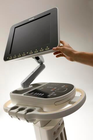 Philips Sparq Ultrasound